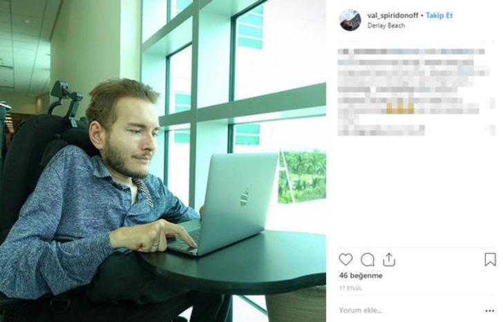 Kafa nakli gönüllüsü bambaşka bir hayat yaşıyor G3