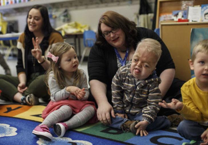 Bu hastalık dünyada yalnızca 30 kişide görülüyor G3