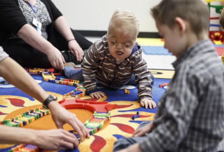 Bu hastalık dünyada yalnızca 30 kişide görülüyor G5