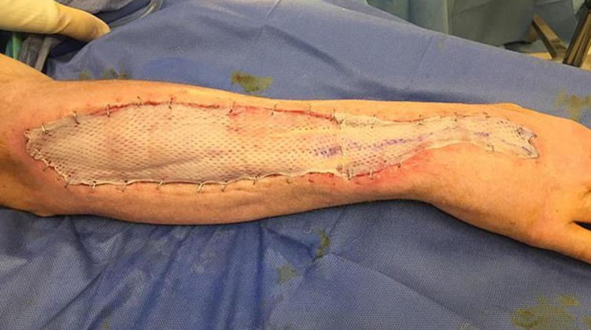 Hapishanede kaptı, kolunu yemeye başladı