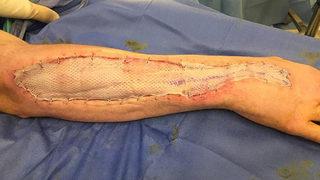 Hapishanede kaptı, kolunu yemeye başladı