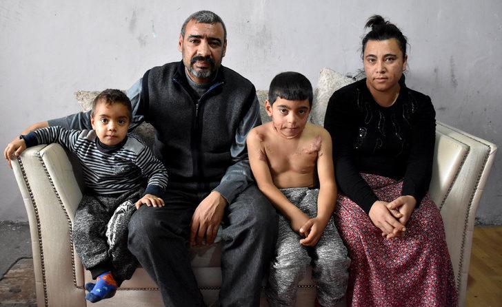 Kimse ikna edemiyor! Vücudundaki yanıklar yüzünden... G3