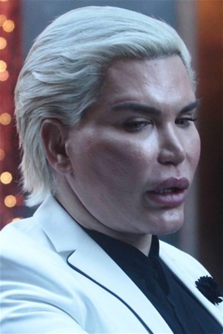 Rodrigo Alves yine ameliyat masasına yattı! Bakın bu kez ne yaptırdı? G2
