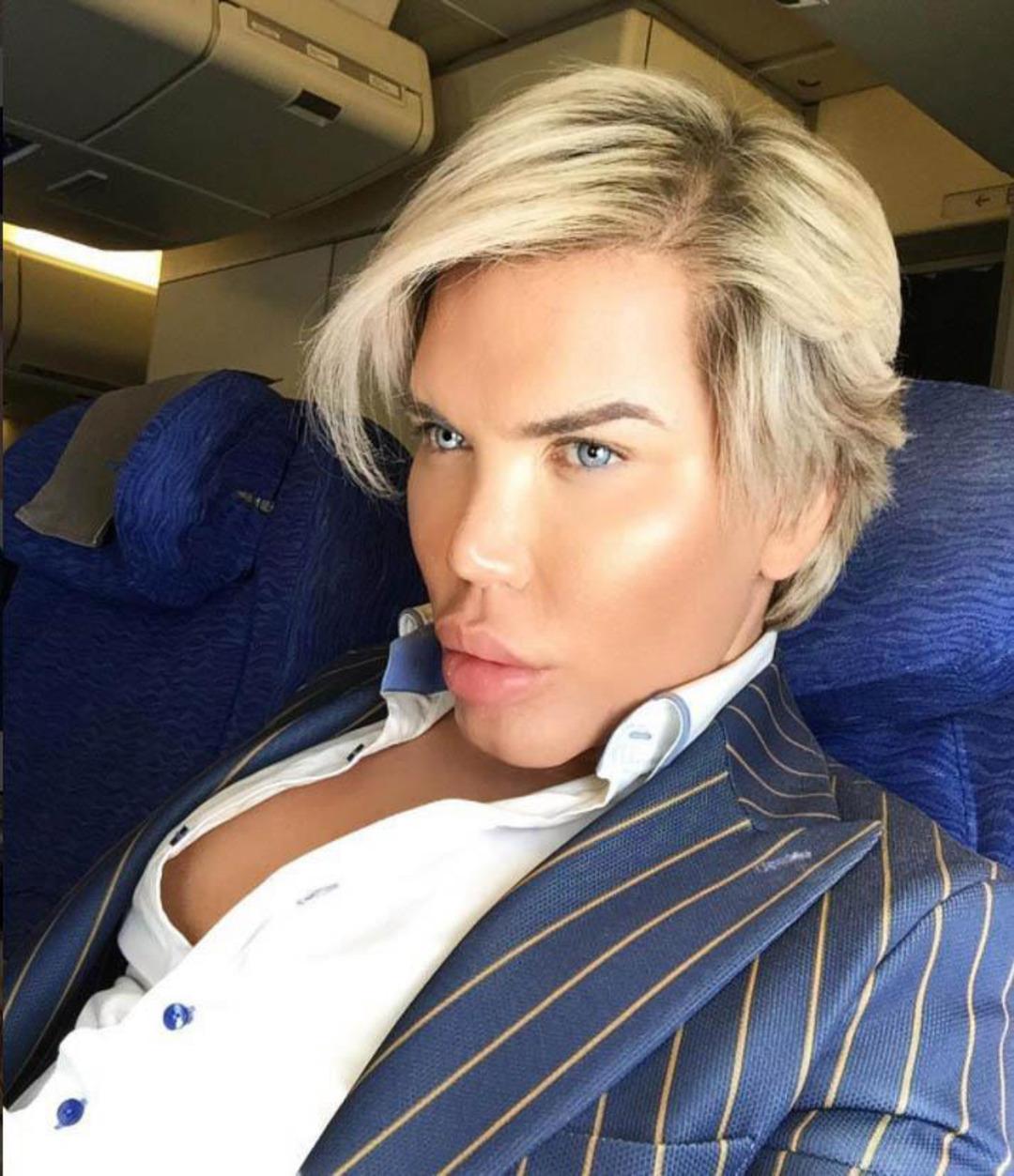 Rodrigo Alves yine ameliyat masasına yattı! Bakın bu kez ne yaptırdı?