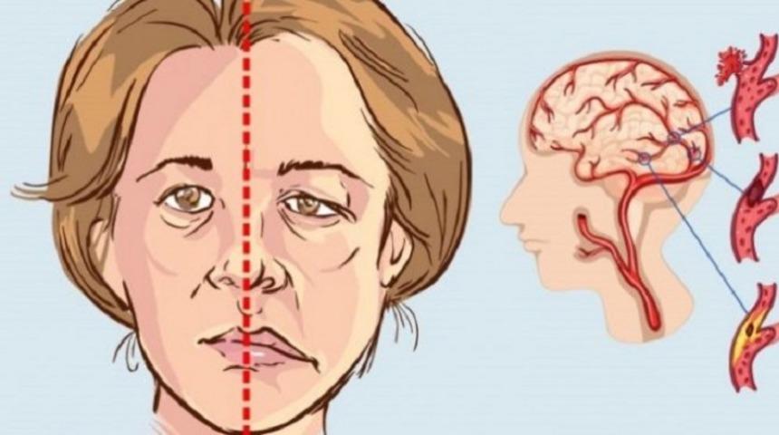 &Ccedil;ok sıcaktan soğuğa &ccedil;ıkmak y&uuml;z felci nedeni!