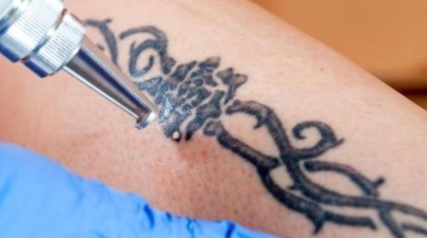 Kalıcı d&ouml;vmesi olanlar bu habere dikkat! Korkutan uyarı