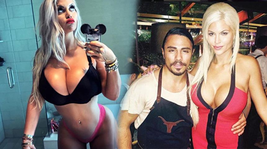 İnce belli olmak için kaburgalarını bile aldırmıştı! Şimdi görenler tanıyamıyor.