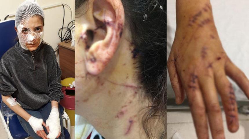 Sokak ortasında dehşeti yaşadı! Tam 80 dikiş aldı