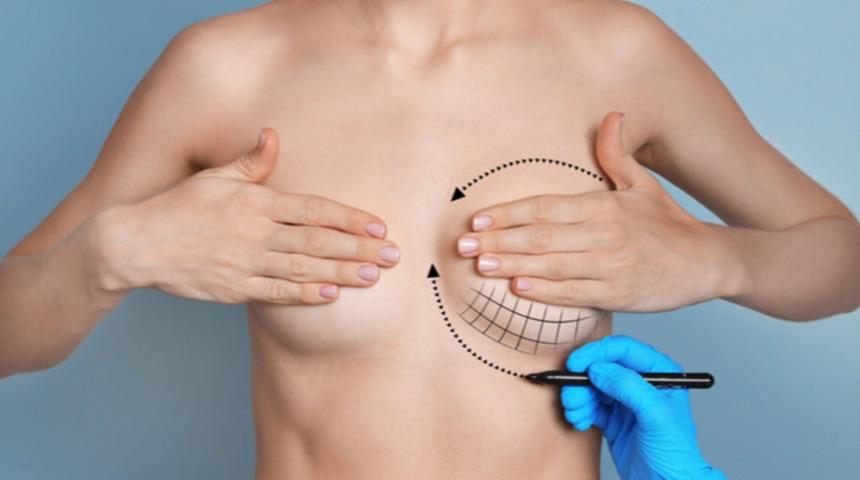 Meme onarımı sonrası iyileşme s&uuml;reci 