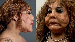 Estetik kurbanı olmayın! İşte yanlış güzellik uzmanı seçtiğinizin 6 işareti