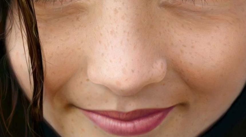 Estetik ameliyatı kararı için ergenlik dönemi çok mu erken?