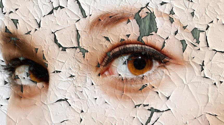 Kışın cilt kuruluğu nasıl önlenir?