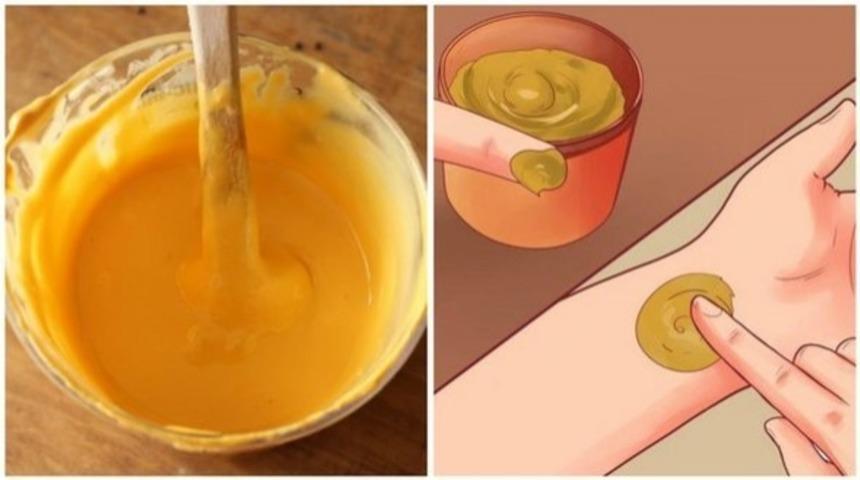  Baharatların Süper Kahramanıyla Tanışın: Hastalıklara Karşı Zerdeçal!