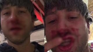 15 kişi Survivor Taner Tarlacı'yı darp etti! Sonrasında ise... 