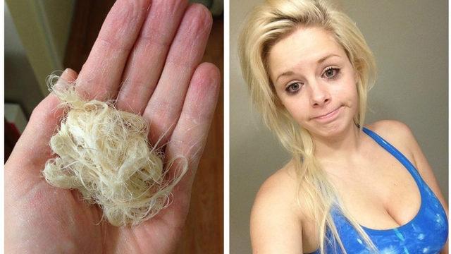 Saçınızın 'çığlık' attığını gösteren işaretler