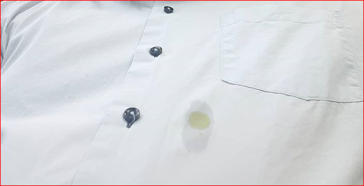  YAĞ LEKELERİ İÇİN