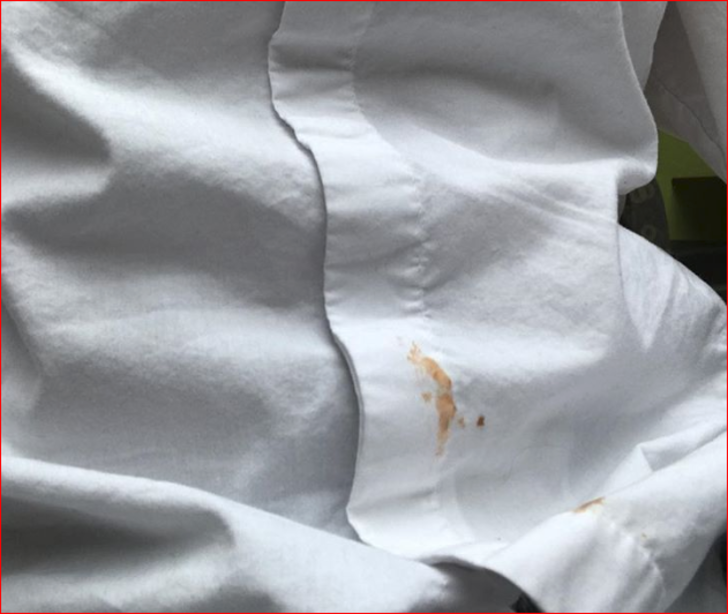  KETÇAP LEKELERİ İÇİN 