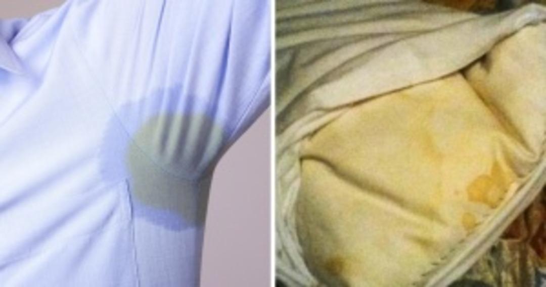 Can sıkıcı lekeleri &ccedil;ıkarmanın kolay yolu