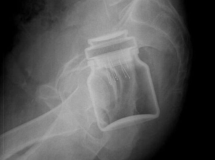 Bu röntgenler şaşkına çeviriyor! G2