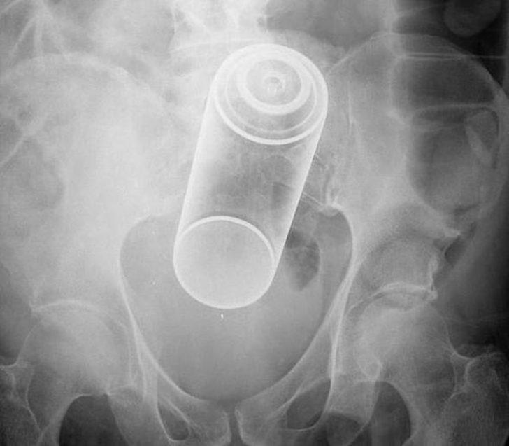 Bu röntgenler şaşkına çeviriyor! G4