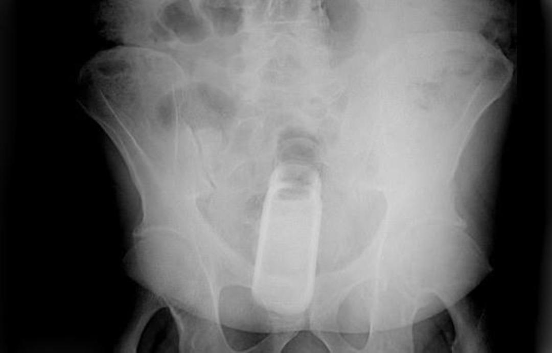 Bu r&ouml;ntgenler şaşkına &ccedil;eviriyor!