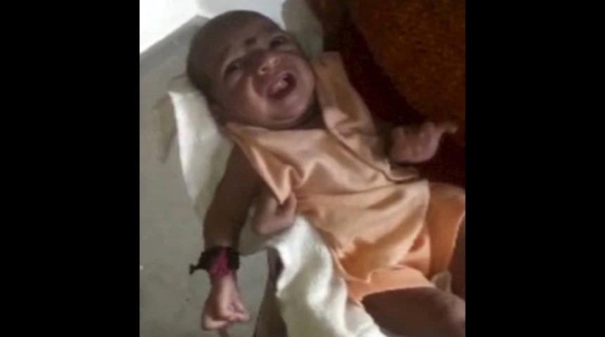 3 kollu doğan bebeği 'kutsal' ilan ettiler