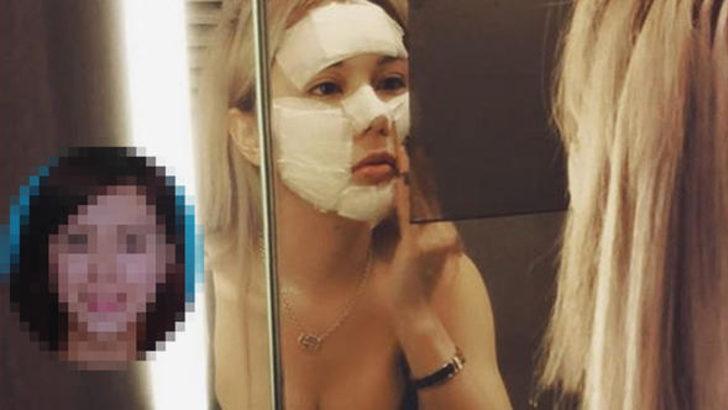 Sevgilisine kızdı 30 kez estetik yaptırdı  G1