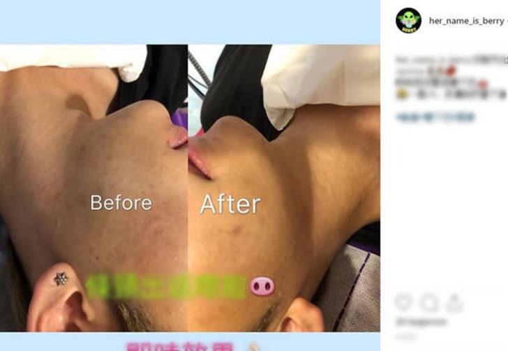 Sevgilisine kızdı 30 kez estetik yaptırdı  G3