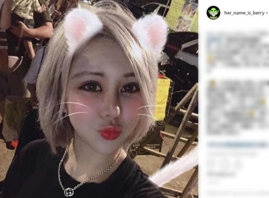 Sevgilisine kızdı 30 kez estetik yaptırdı 