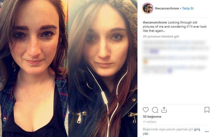 Kanser savaşçısı Jen Taylor'ın inanılmaz değişimi  G1