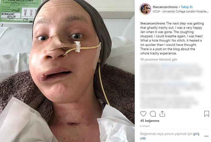 Kanser savaşçısı Jen Taylor'ın inanılmaz değişimi  G3