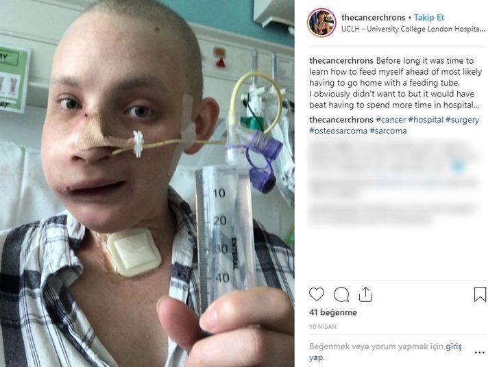 Kanser savaşçısı Jen Taylor'ın inanılmaz değişimi  G4