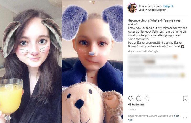 Kanser savaşçısı Jen Taylor'ın inanılmaz değişimi  G5