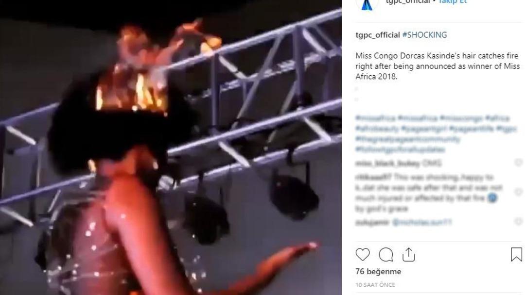 Sa&ccedil;ları alev alev yandı! G&uuml;zellik yarışmasında şoke eden anlar 