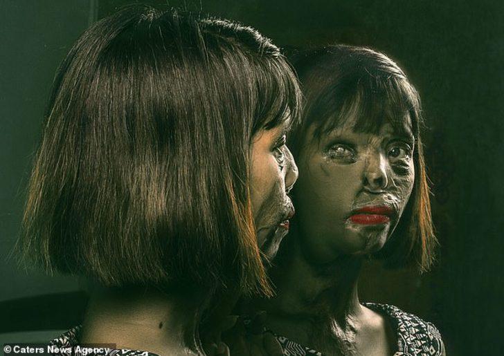 Babası tarafından asit saldırısına uğradı annesi ise öldürüldü! Saldırının nedeni ise tüyler ürpertiyor