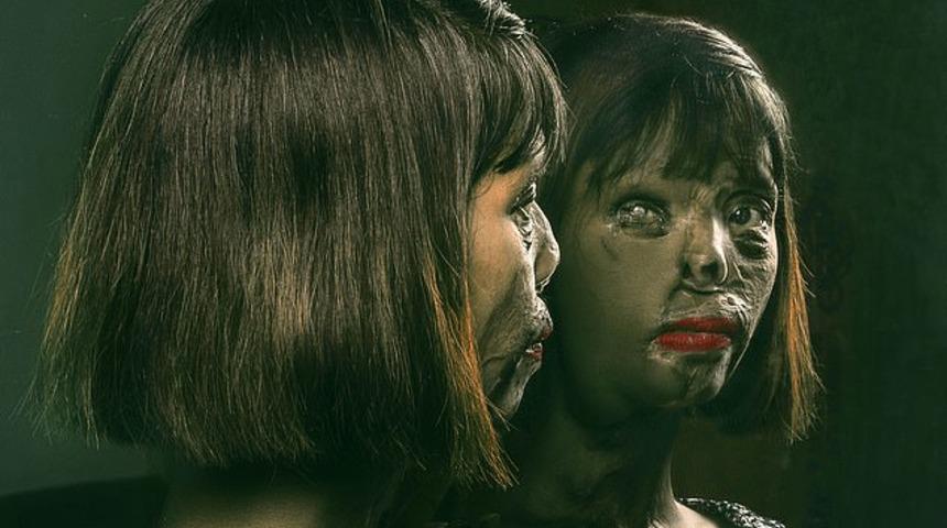 Babası tarafından asit saldırısına uğradı annesi ise &ouml;ld&uuml;r&uuml;ld&uuml;! Saldırının nedeni ise t&uuml;yler &uuml;rpertiyor