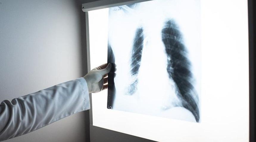 Öksürüğünüz uzun sürüyorsa dikkat! 