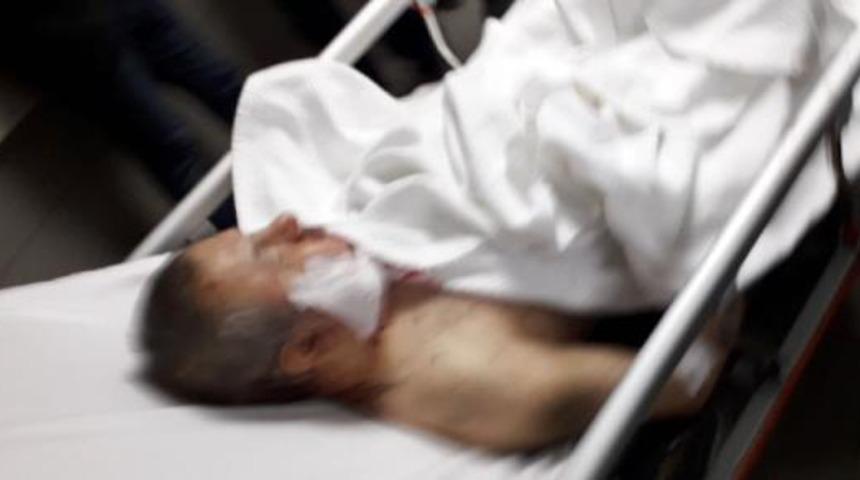 İYİ Parti'den aday adayı olan Hüsamettin Kul, başından bıçaklandı