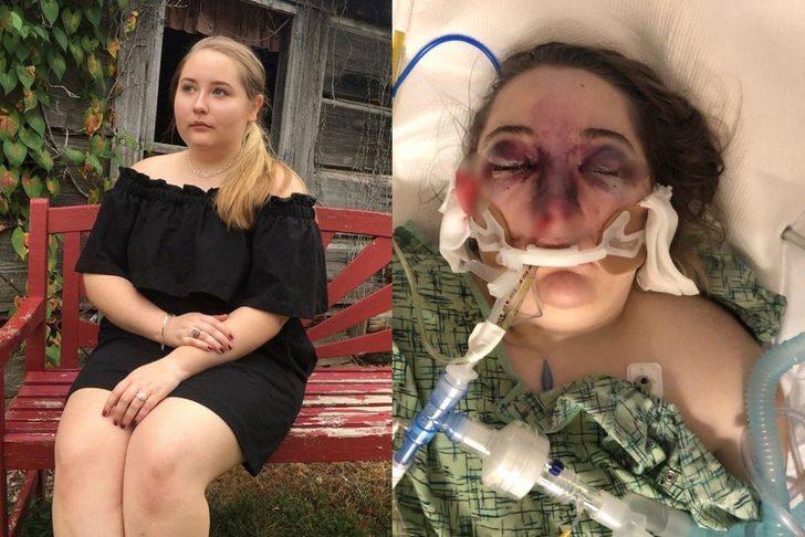 Ailesiyle mavi tura çıktı, bu hale geldi!  G1