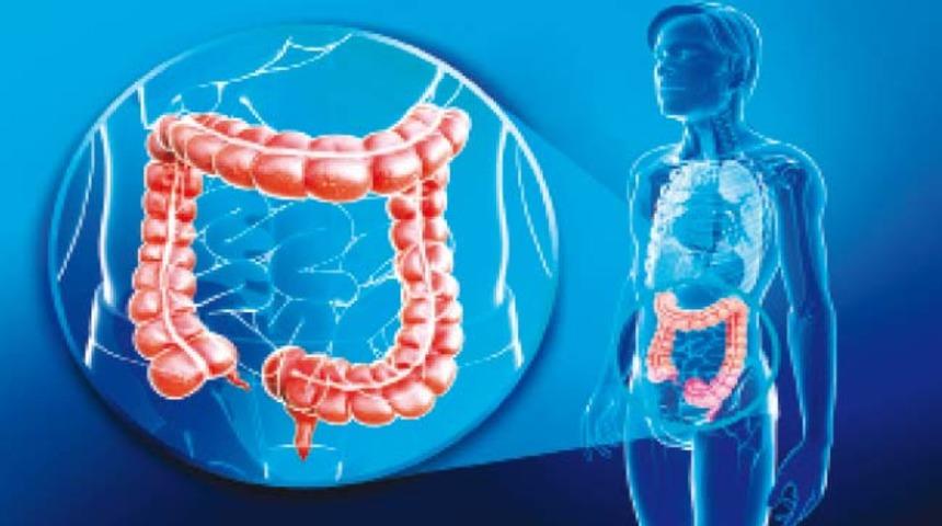 Kolon kanseri tedavisi ve rektum kanseri tedavisi nasıl yapılır?