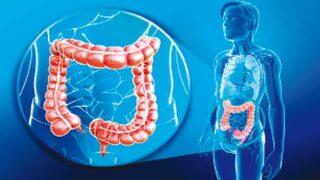 Kolon kanseri tedavisi ve rektum kanseri tedavisi nasıl yapılır?