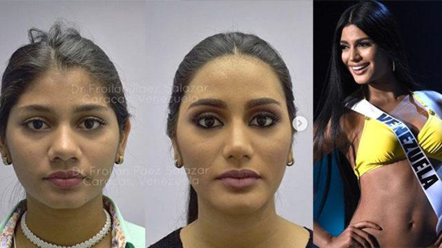 Kainat Güzellik Yarışması’nda üçüncü olan Venezuela Güzeli estetikli çıktı