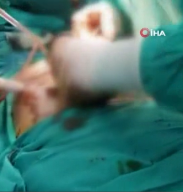 Midesinden çıkanlar doktorları bile şaşırttı! Tam 700 gram G1