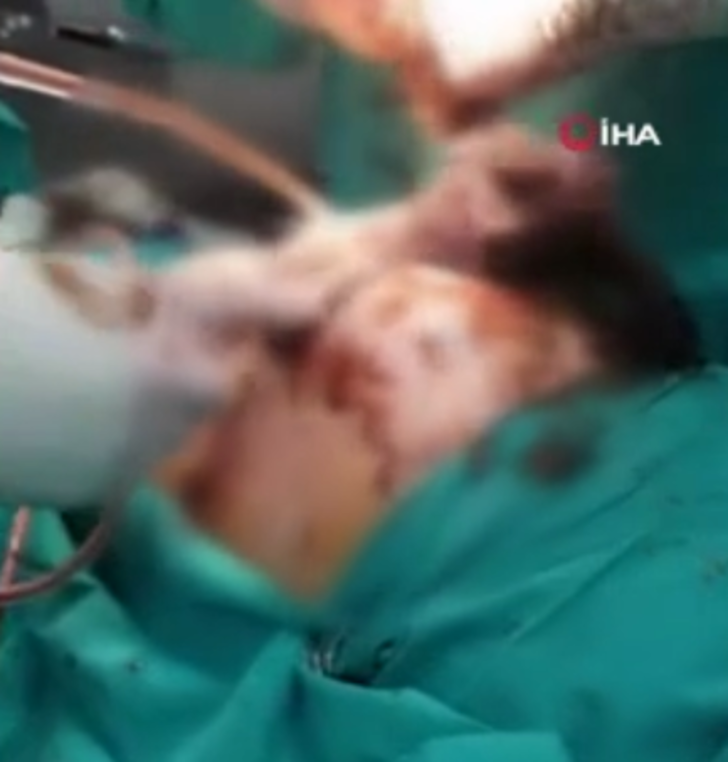 Midesinden çıkanlar doktorları bile şaşırttı! Tam 700 gram G3