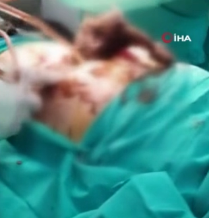 Midesinden çıkanlar doktorları bile şaşırttı! Tam 700 gram G4