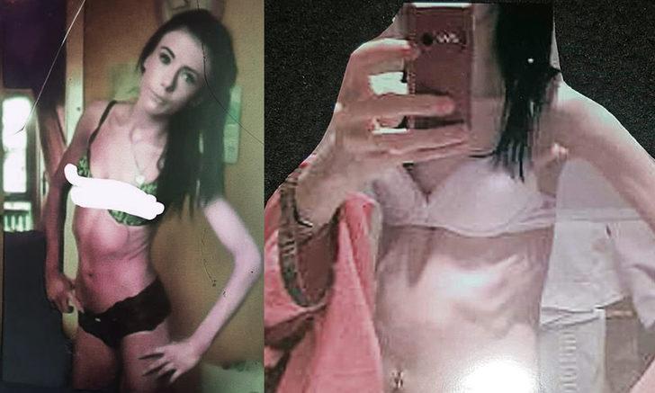 Doğmamış bebeği hayatını kurtardı! 'Kilo aldırır diye diş macunu bile kullanmıyordum'