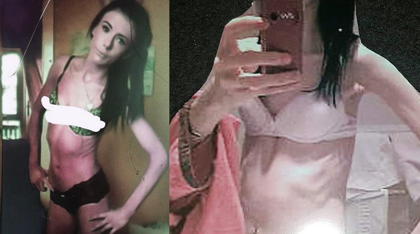 Doğmamış bebeği hayatını kurtardı! 'Kilo aldırır diye diş macunu bile kullanmıyordum'