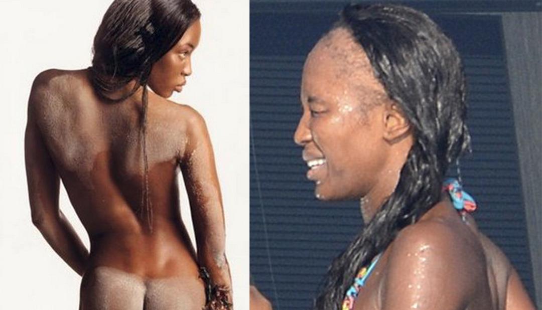 Postiş (takma sa&ccedil;) bir&ccedil;ok kadının kabusu! &Uuml;nl&uuml; &uuml;ns&uuml;z bir&ccedil;ok kadın bu y&uuml;zden kel kalıyor