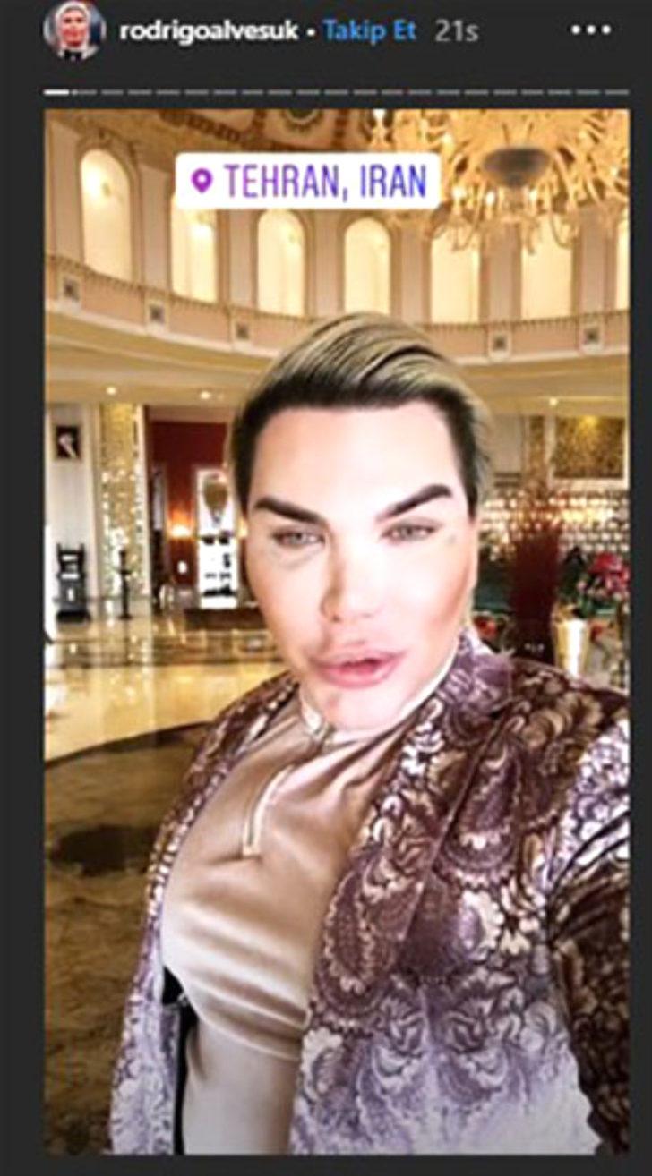 Estetik bağımlısı 'Ken Bebek' yine uslu durmadı  G1