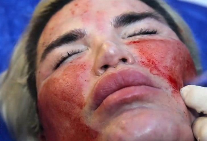 Estetik bağımlısı 'Ken Bebek' yine uslu durmadı  G4